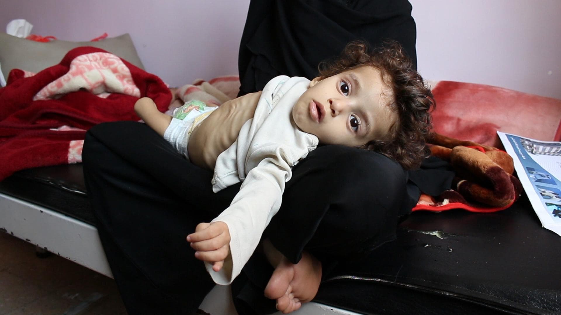 Fact Check: CBS Using Yemen child picture
