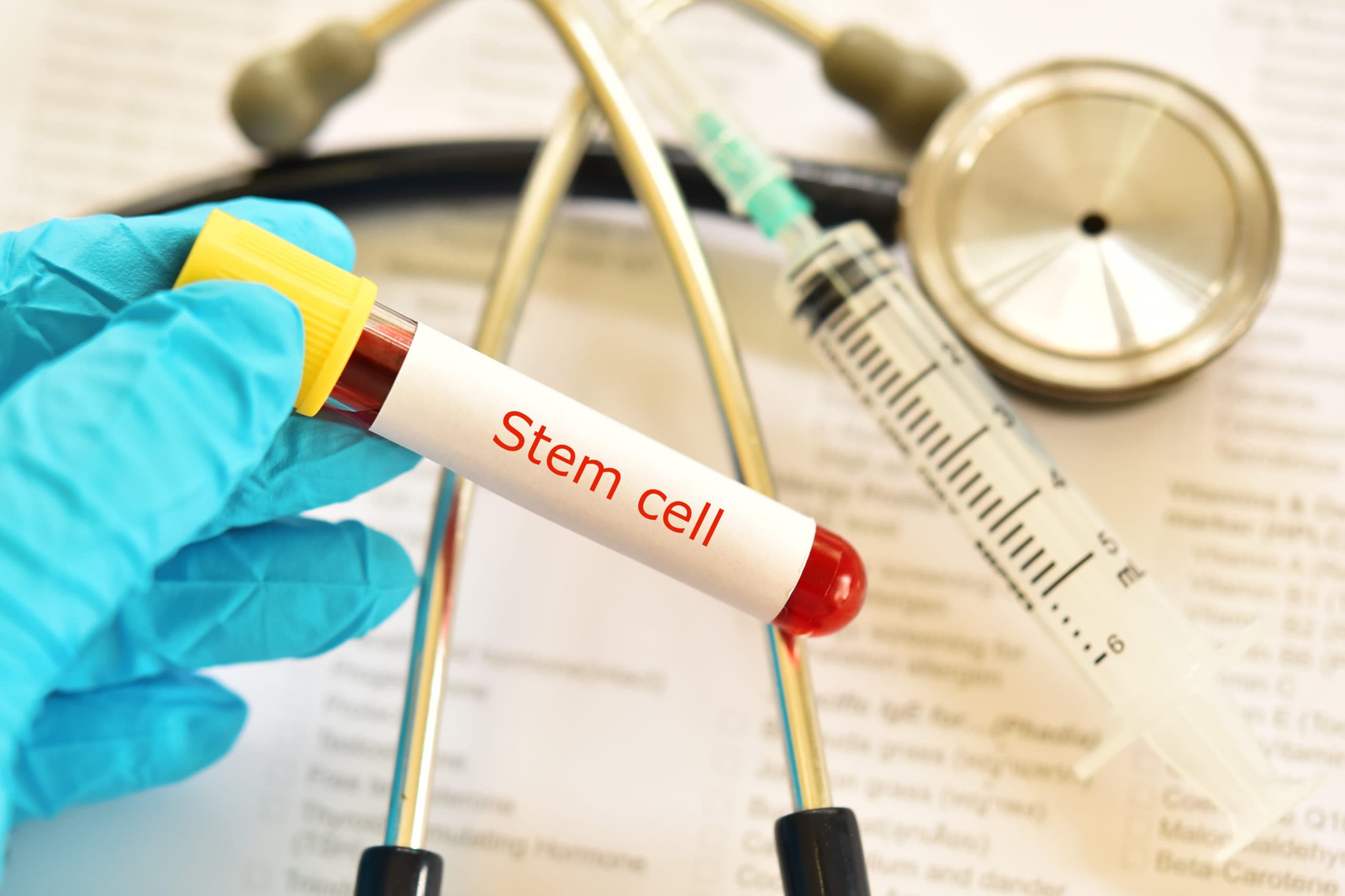Fact Check: Stem cell banking can reduce immune rejection risks in therapies.