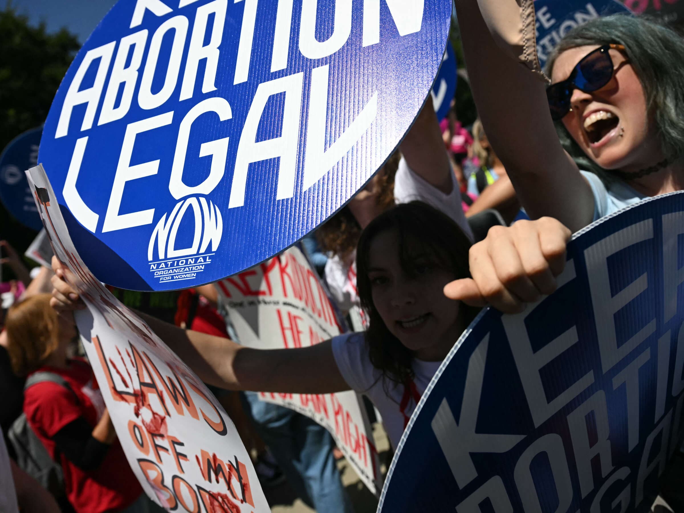 Fact Check: Abortion is regulated differently in each U.S. state.