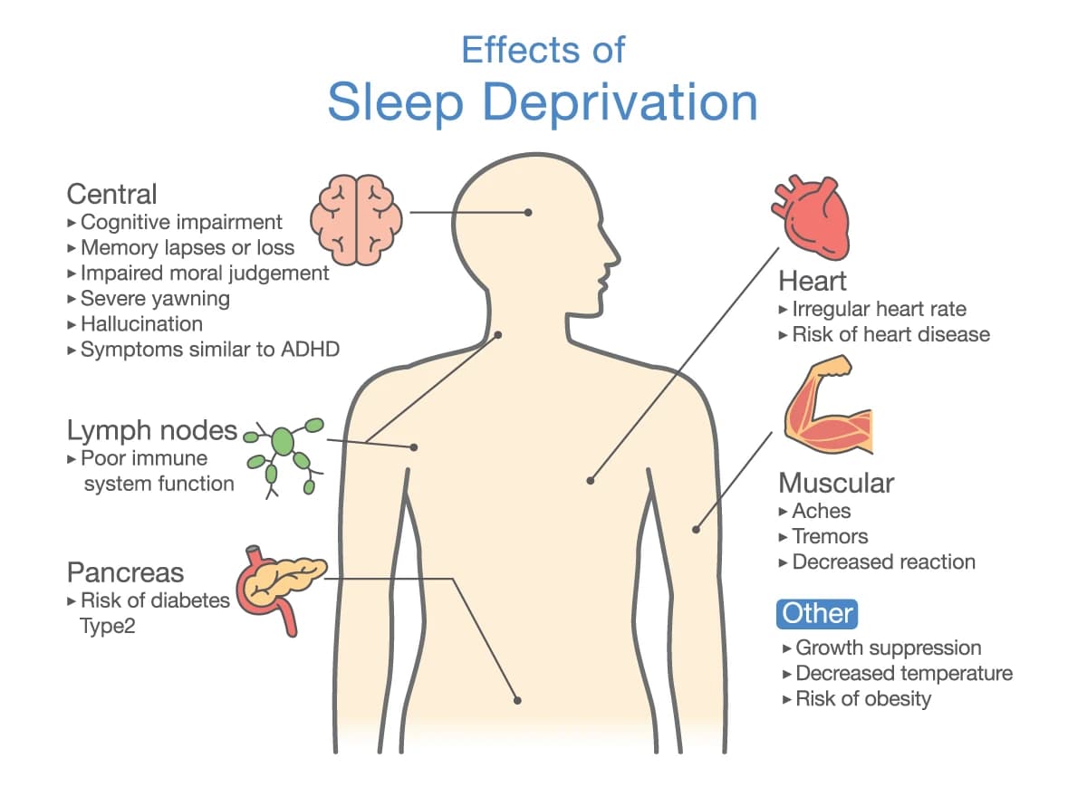 Fact Check: Sleep deprivation can lead to serious health issues.