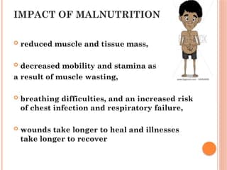 Fact Check: Malnutrition can result in severe health consequences.
