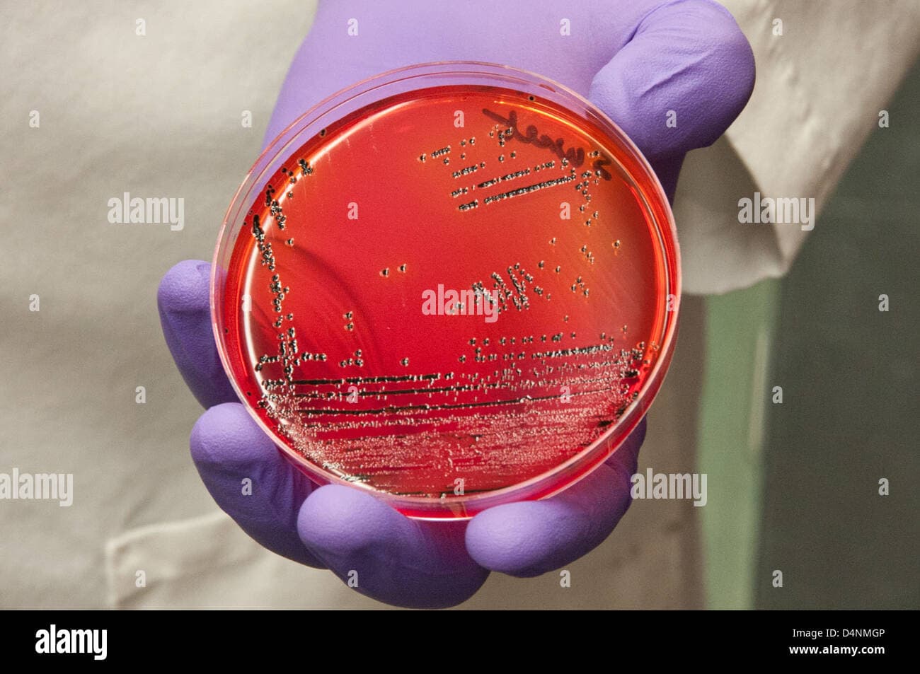 Fact Check: The FDA oversees the safety and efficacy of food and drugs in the US.