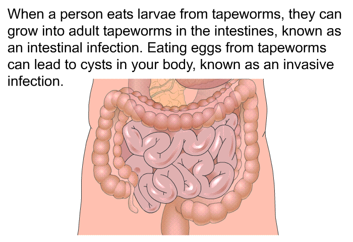 Fact Check: Can a bowl of milk lure out tapeworm from inside your body?
