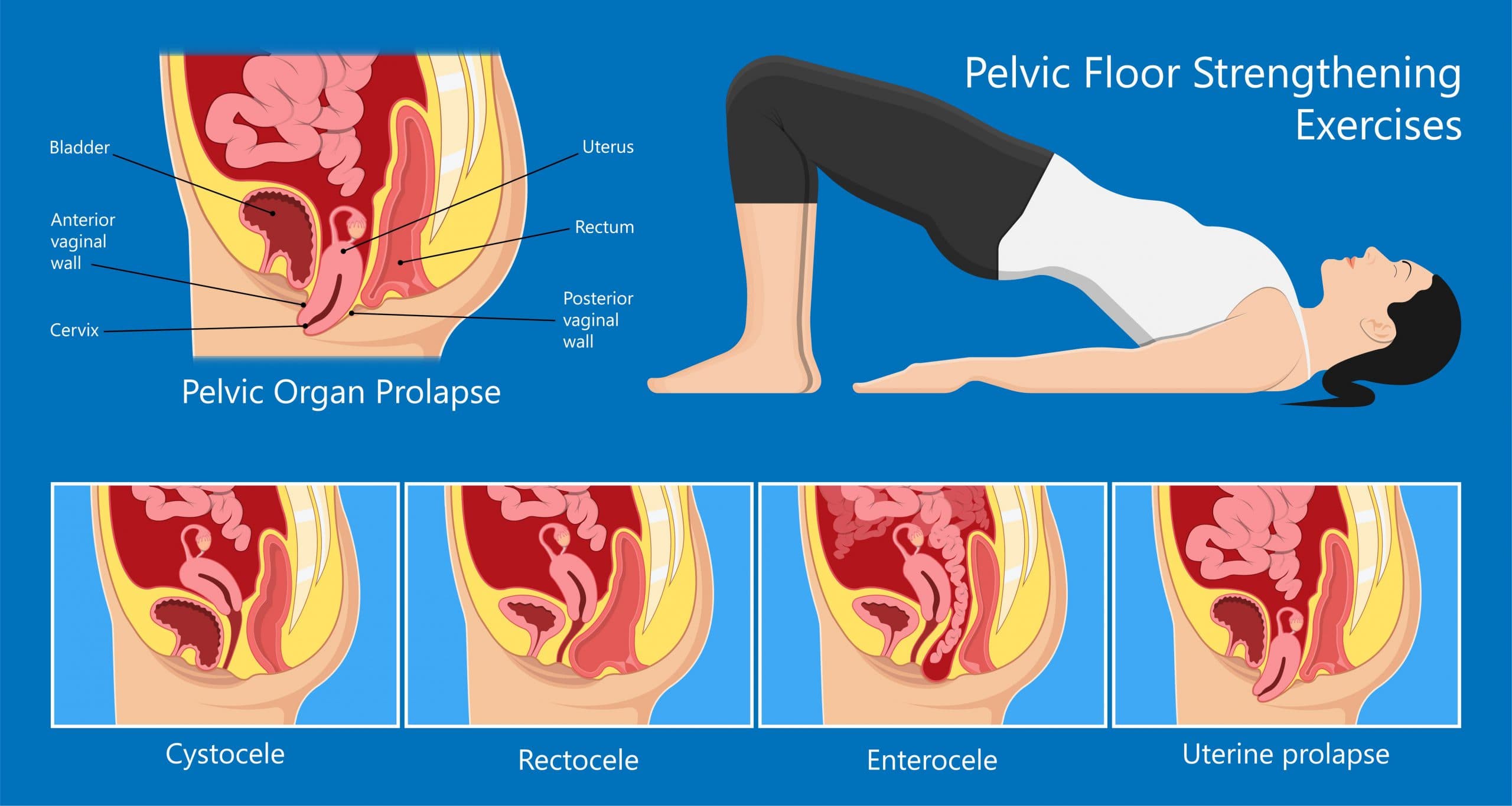 Fact Check: Pelvic pt 