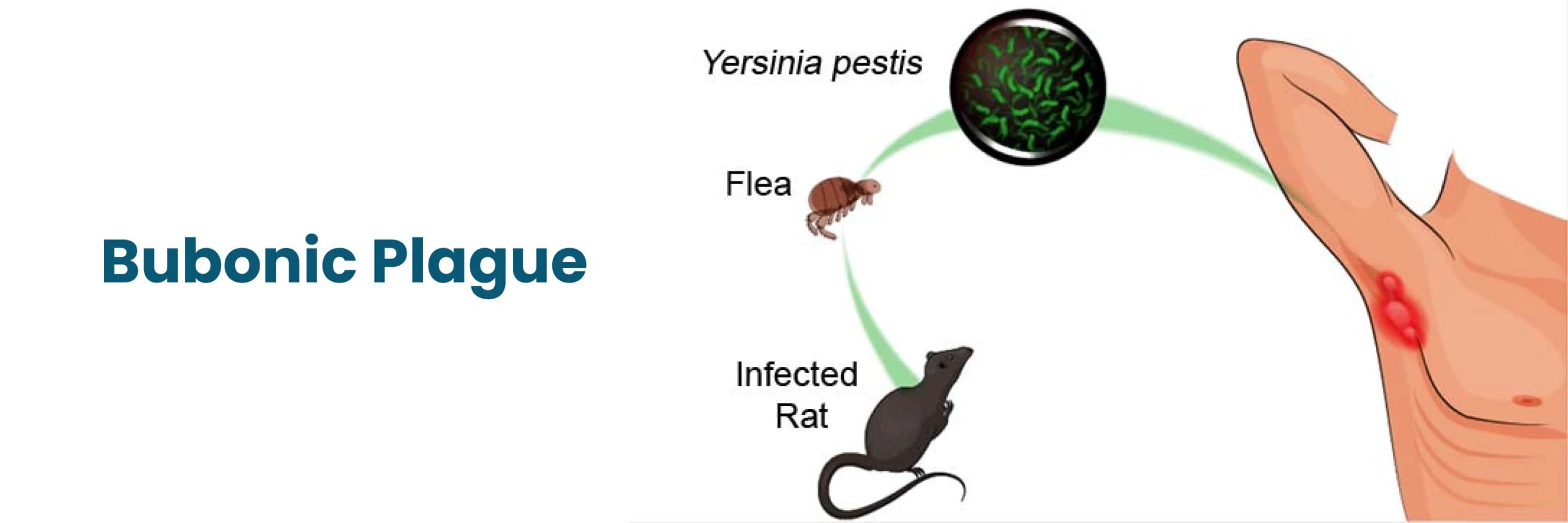 Fact Check: Plague is easily treated with antibiotics.