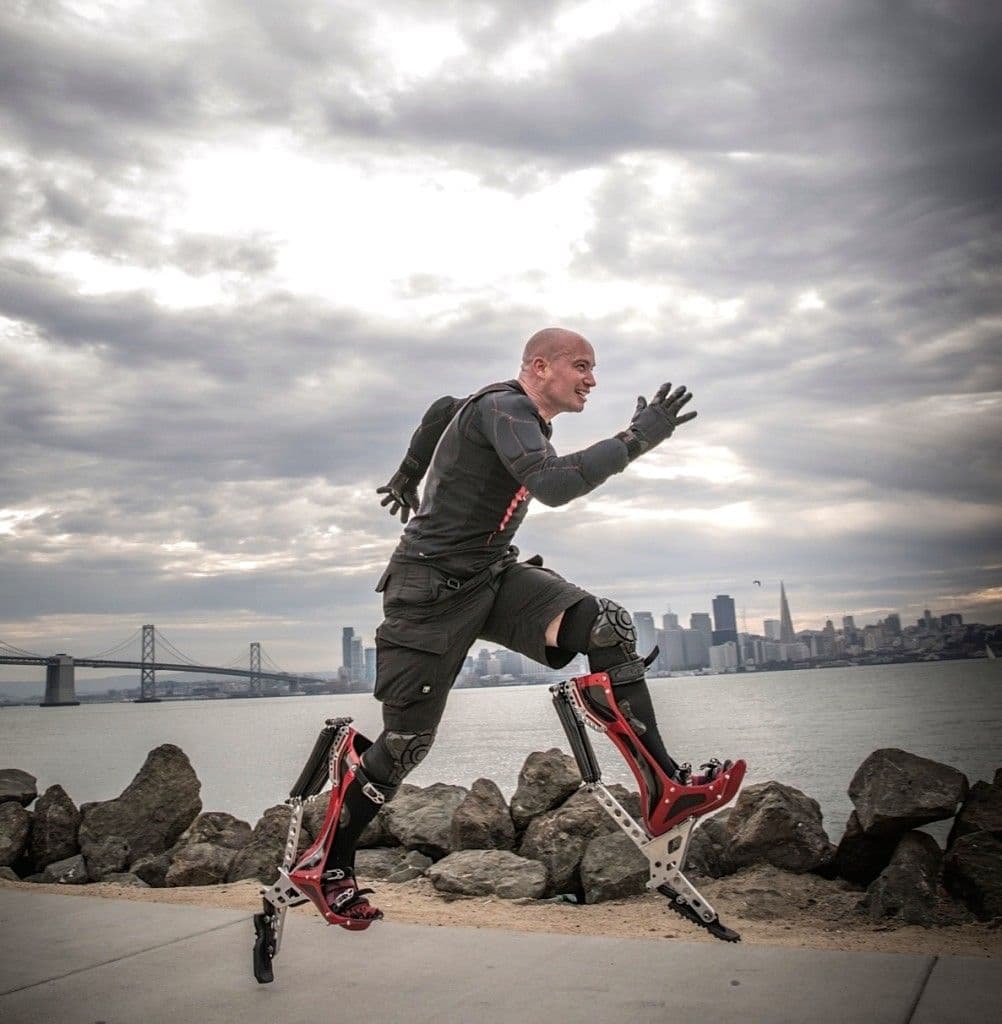 Fact Check: Are bionic shoes good for your feet