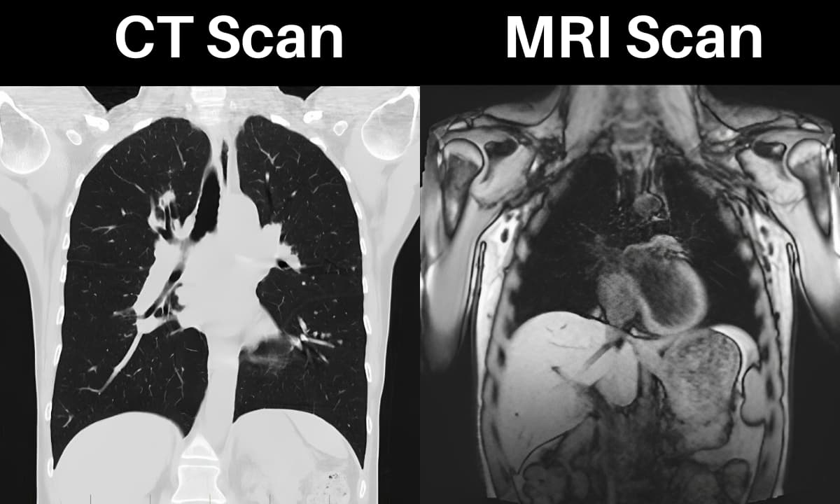 Fact Check: Are CT scan and MRI the same?