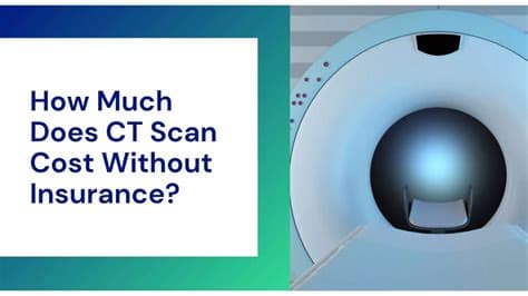 Fact Check: Are CT scans covered by insurance?