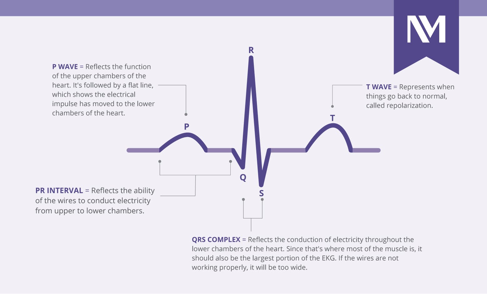 Fact Check: Are EKGs expensive?
