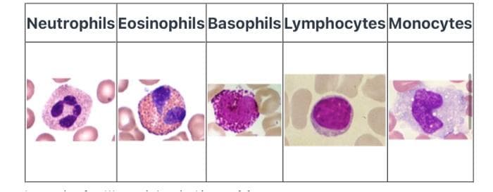 Fact Check: Are eosinophils lymphocytes?