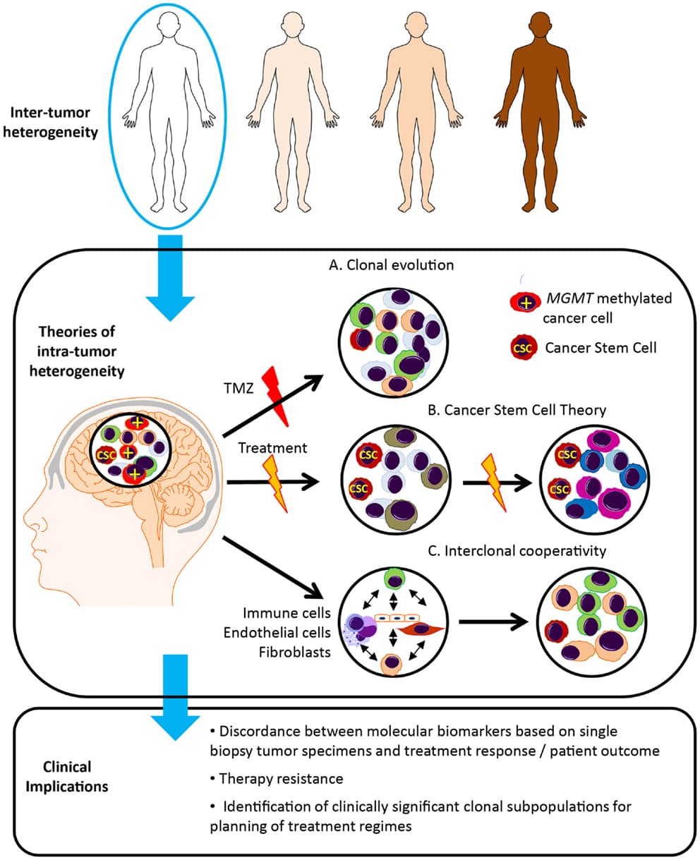 Fact Check: Are GBM tumors hereditary?
