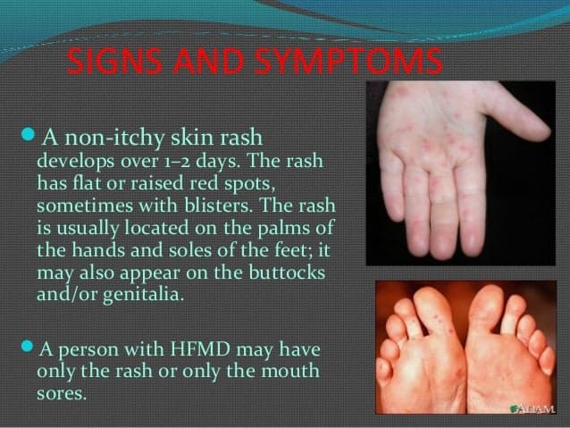 Fact Check: Are HFMD spots itchy?