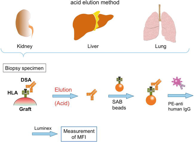 Fact Check: Are HLA antibodies naturally occurring?