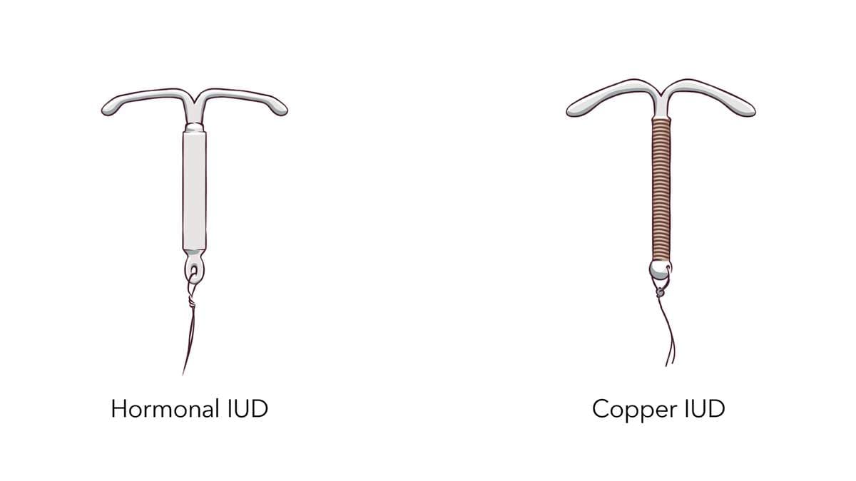 Fact Check: Are IUDs hormonal?