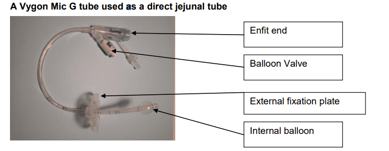 Fact Check: Are JJ tubes good?
