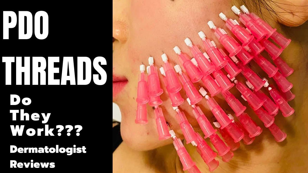 Fact Check: Are PDO threads worth it?