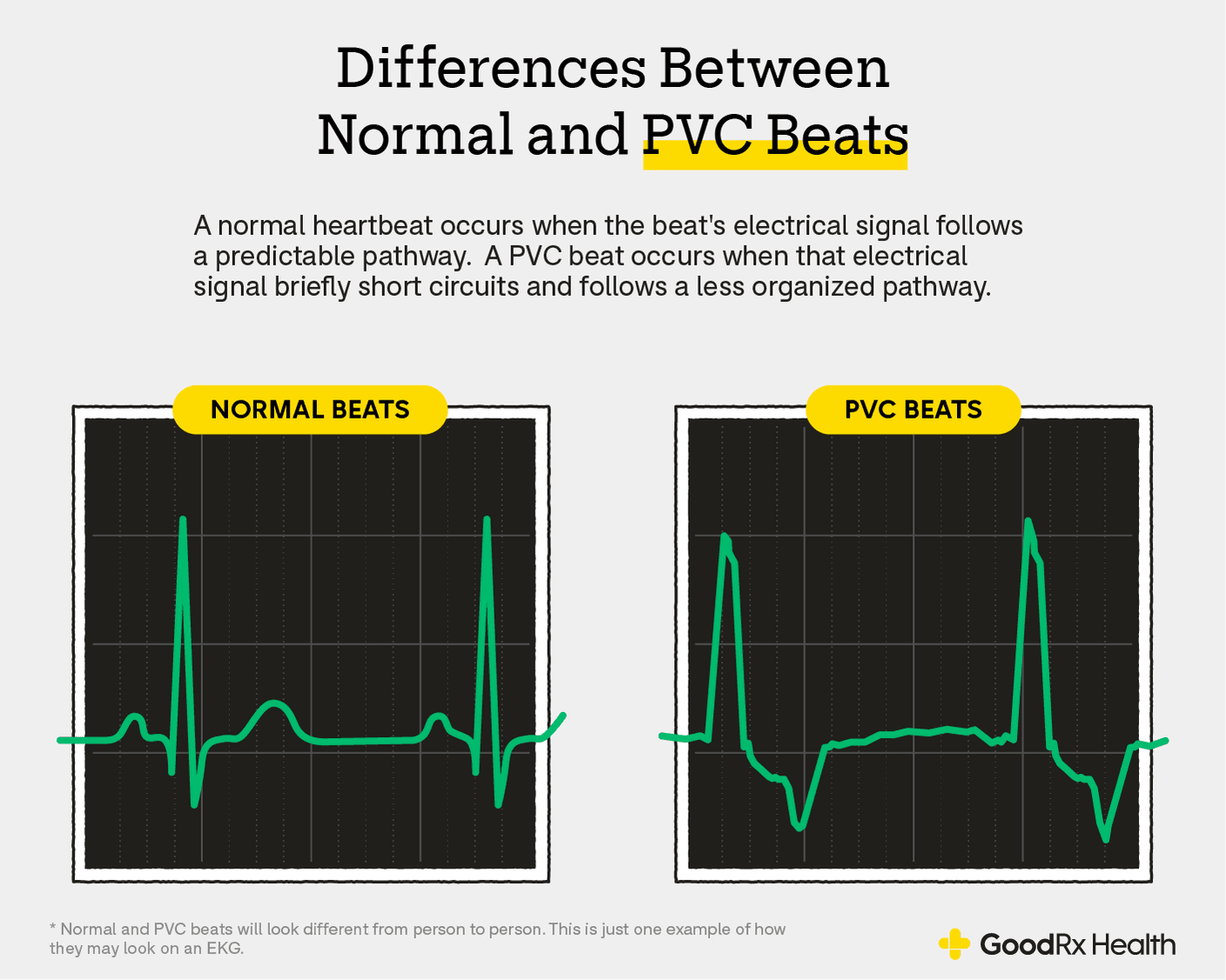 Fact Check: Are PVCs bad?