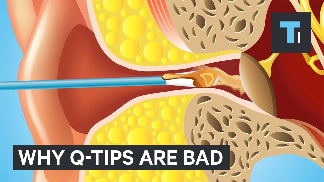 Fact Check: Are Q-tips bad?