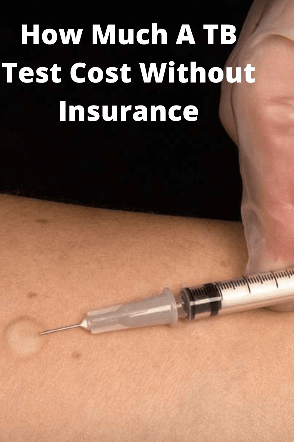 Fact Check: Are TB tests covered by insurance?