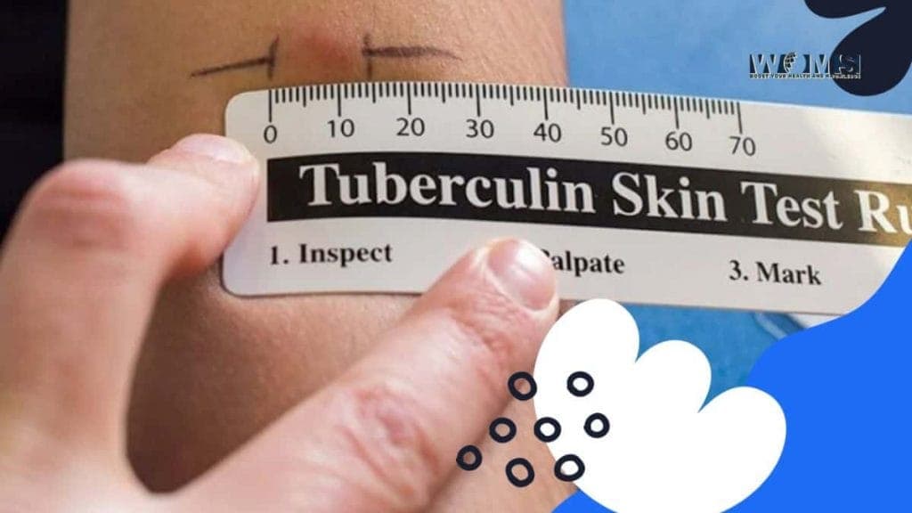 Fact Check: Are TB tests free?