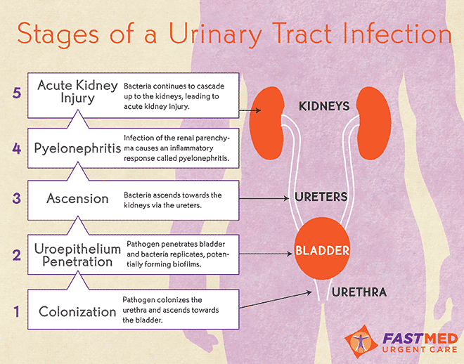 Fact Check: Are UTIs continuous?