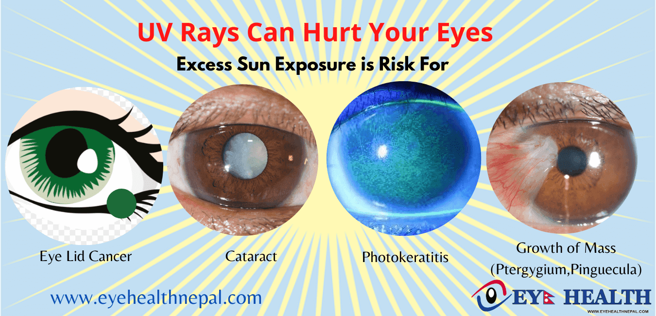 Fact Check: Are UV rays harmful?