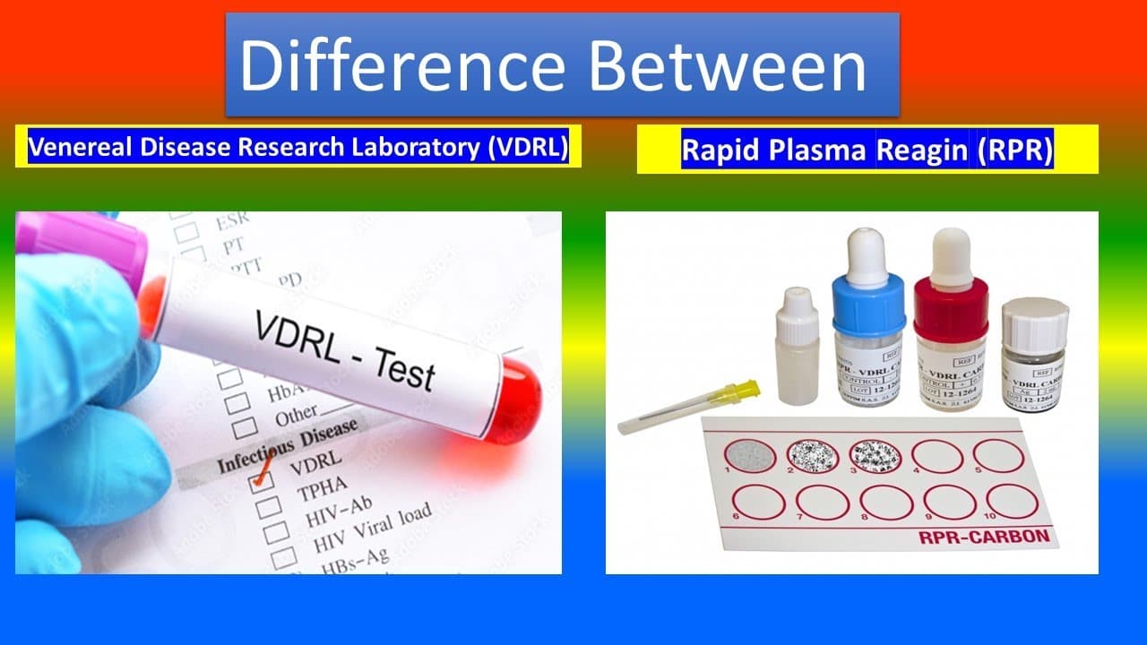 Fact Check: Are VDRL and RPR tests the same?