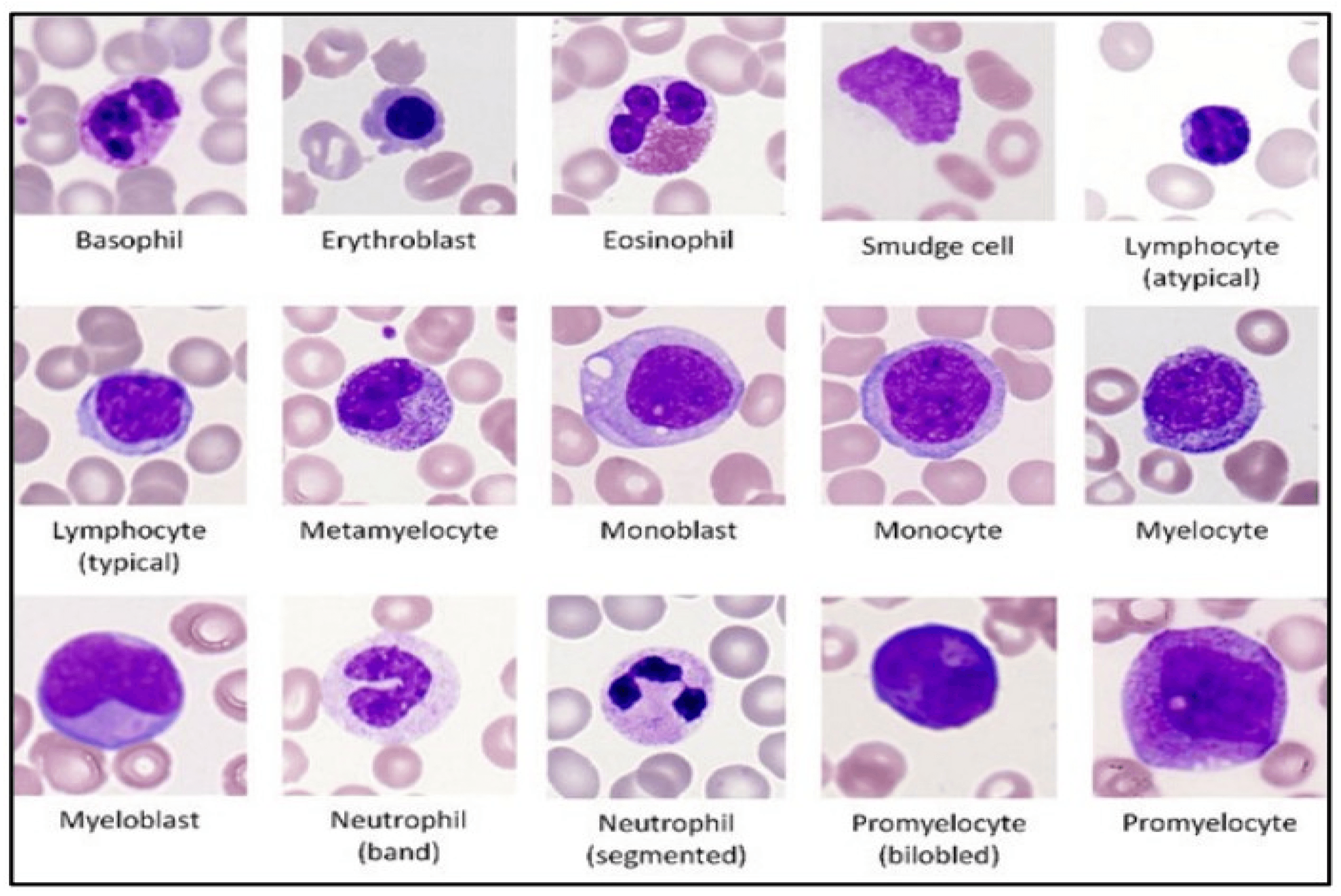 Fact Check: Are WBC in plasma?