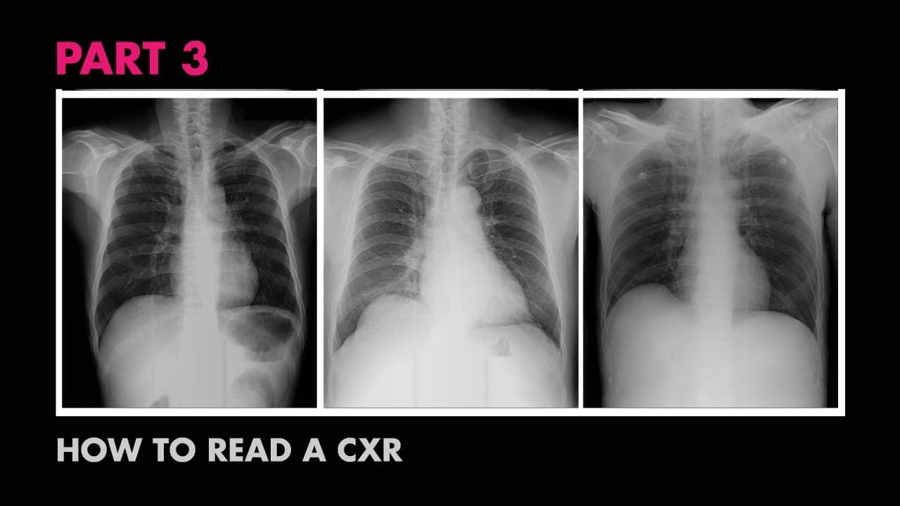 Fact Check: Are X-rays free?