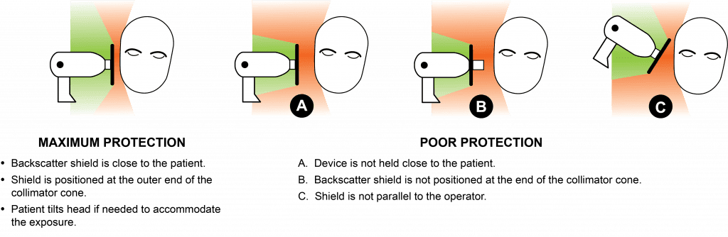 Fact Check: Are X-rays safe?
