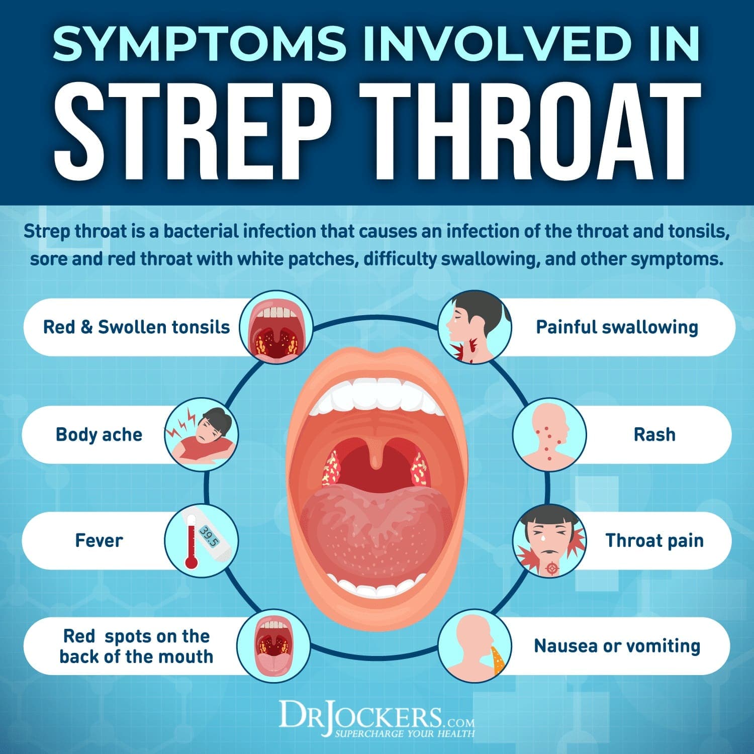 Fact Check: Are Zpacks good for strep throat?