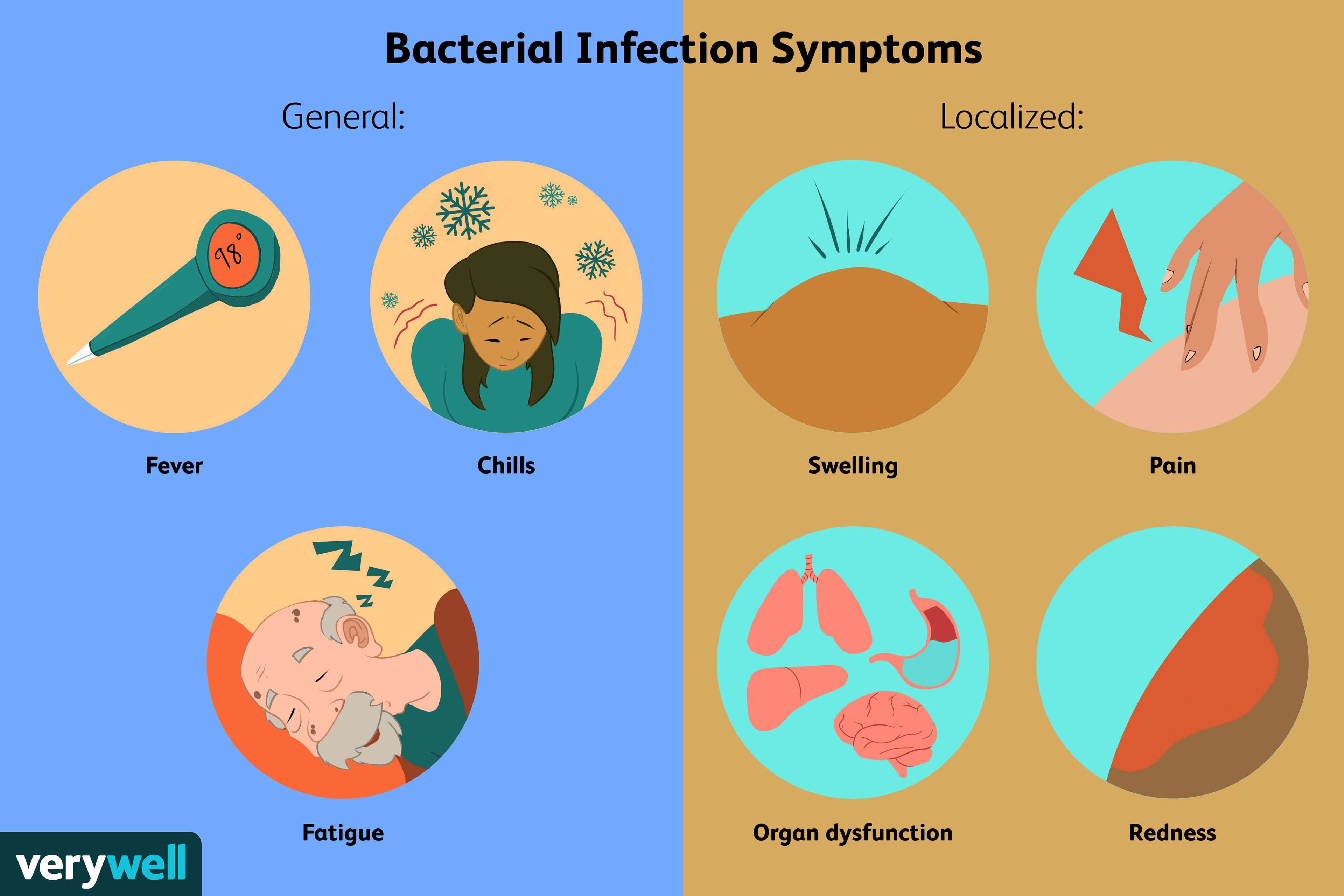Fact Check: Are bacterial infections contagious?