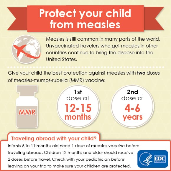 Fact Check: Measles is not a dangerous disease for children 


