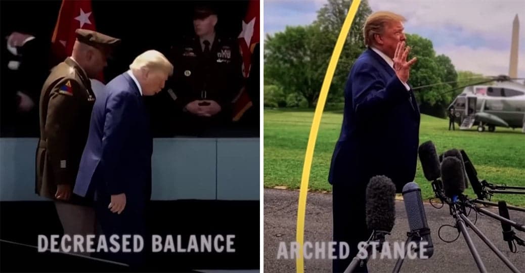 Fact Check: Trump has frontal lobe dementia
